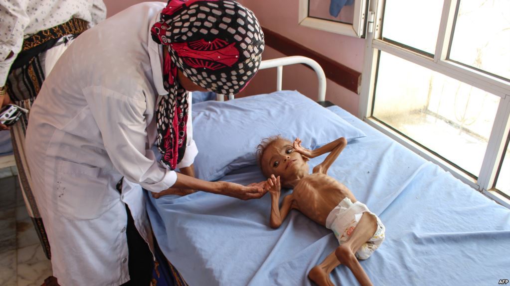 تحذيرات أممية من خطر كبير يتربص باليمن وثلاث دول أخرى