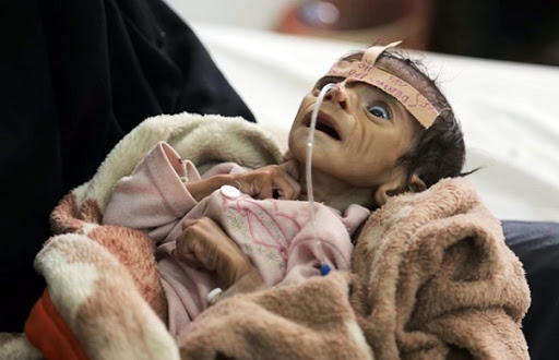 قاتل آخر يتربص بملايين الأشخاص في اليمن