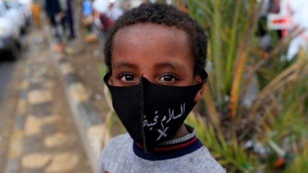 الأمم المتحدة تحدد خمسة أسباب تجعل وضع اليمن أكثر خطورة(التفاصيل) 