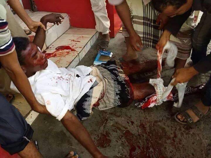 مسلحون حوثيون يقمعون مظاهرة سلمية في الحديدة بالرصاص الحي ويصيبون شخصين ويعتقلون آخرين