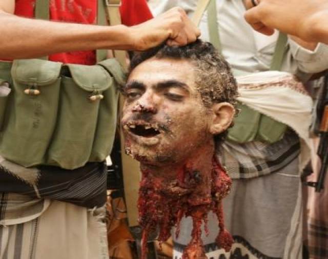 الانتحاري عماد المشيبي الذي قتل في التفجير الانتحاري بمنطقة امصر