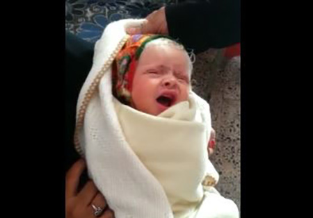 بالفيديو: امرأه يمنية تلد طفلة بشعر ابيض 