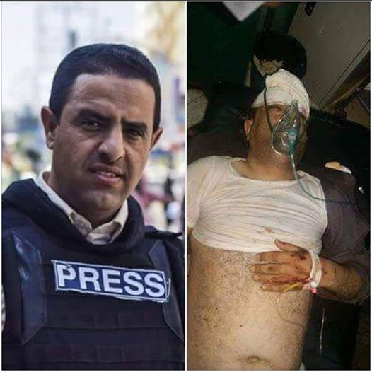 الصحفي محمد طاهر يتعرض لحادث مروري على خط تعز لحج (صورة)