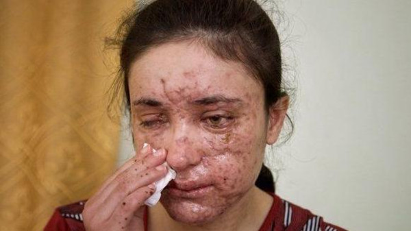 الفتاة الإيزيدية لمياء بشار التي تمكنت من الهرب من داعش