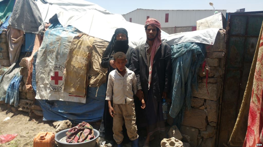 مواطن يمني من شريحة المهمشين يتحدث عن التمييز الذي يتعرضون له