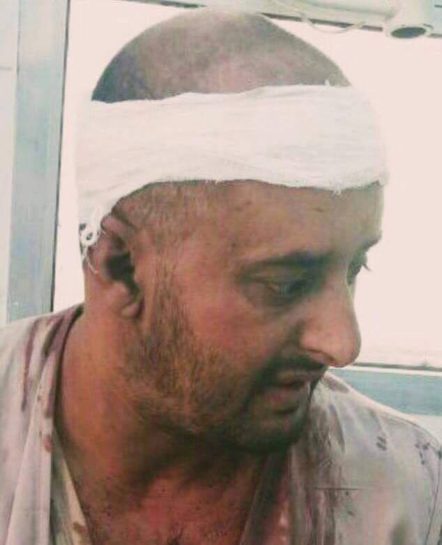 إصابة مصور قناة سهيل بشظايا قذيفة في نهم