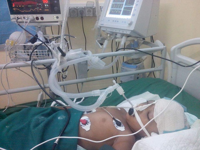 انعدام الأكسجين في مستشفيات تعز بسبب الحصار التي تفرضه الميليشيا