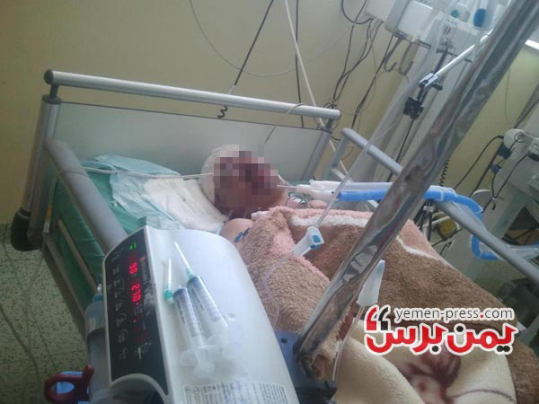استشهاد الرائد محمد الفيل متأثرا بإصابته برصاص القاعدة الأربعاء الماضي بصنعاء