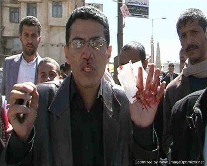 اعتداء سابق على عبدالله غراب من قبل أنصار علي عبدالله صالح (أرشي