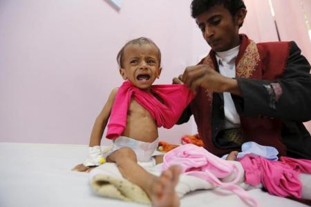 الأمم المتحدة 7 مليون يمني بحاجة إلى إغاثة عاجلة