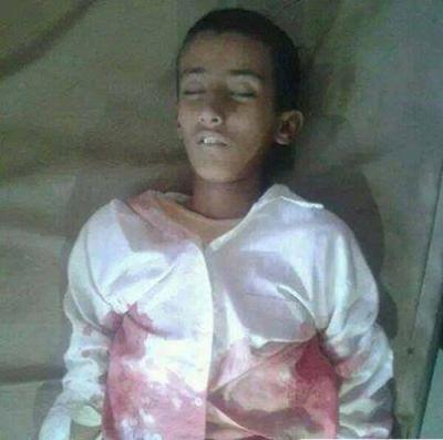 طفل سقط بنيران قوات الجيش اليمني في أحد مناطق محافظة الضالع قبل 