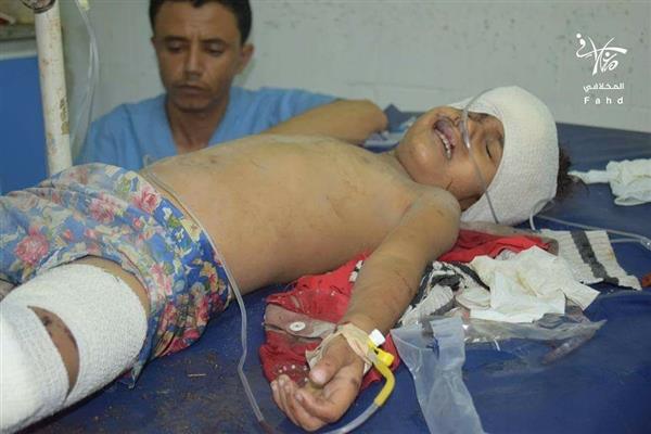 شهيدان وستة جرحى في مجزرة جديدة للحوثيين بحق المدنيين في تعز