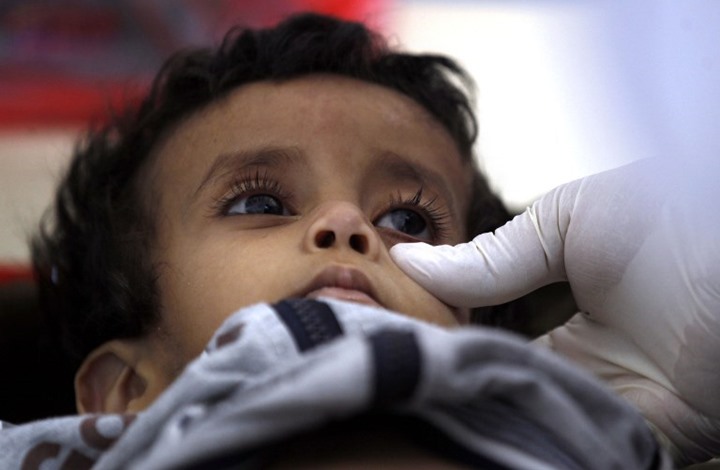 الكوليرا تنتشر بمناطق الحوثي وتقتل مئات اليمنيين (أرقام)