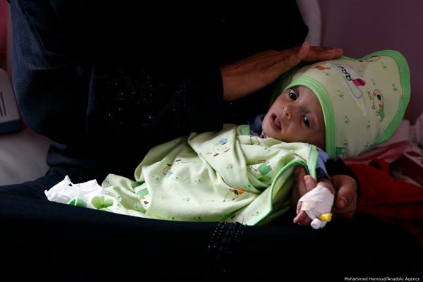 خمسة أطفال يموتون كل ساعة في اليمن