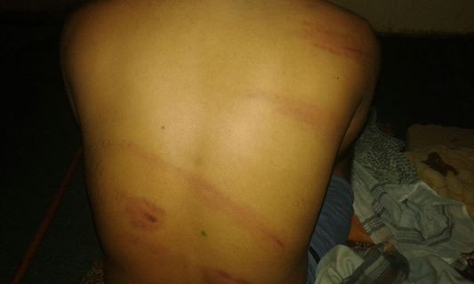 نقطة أمنية في لحج تحتجز عدد من المسافرين وتقوم بتعذيبهم بشكل وحشي (صور)