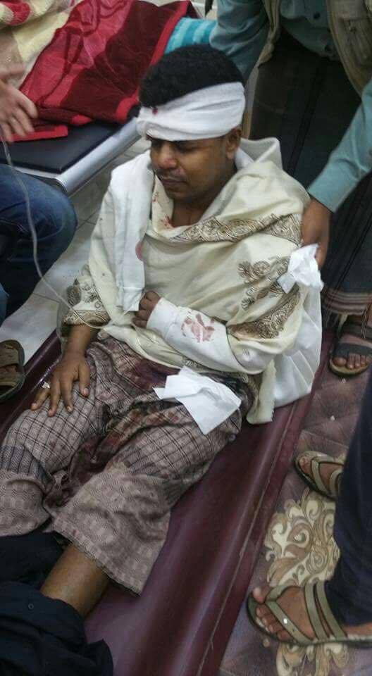 صورة وحدث: إصابة الفنان بلال الأغبري بقصف مليشيات الحوثي على تعز