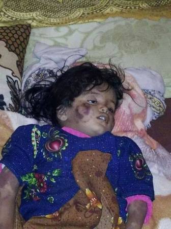 مقتل طفله في العامين من عمرها على يد والدها بعمران بسبب مشاكل اسرية (صوره)