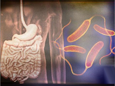 رابط بين بكتيريا الأمعاء والسكّري  