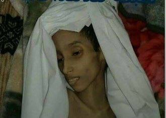 جريمة لاانسانية تهز محافظة المحويت بحق طفلة ذات 11 ربيعاً